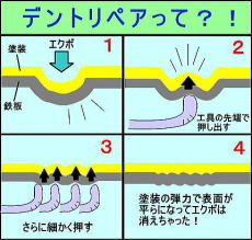 ４コママンガ　デントリペアって？